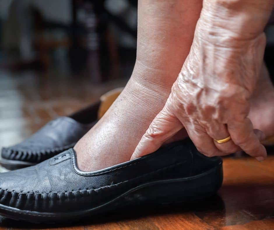 Swollen feet and ankles in elderly